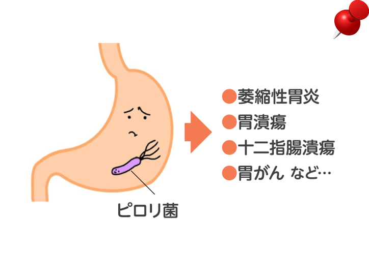 ピロリ菌治療イメージ図